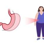 Cartoon stomach and person symbolizing metabolism